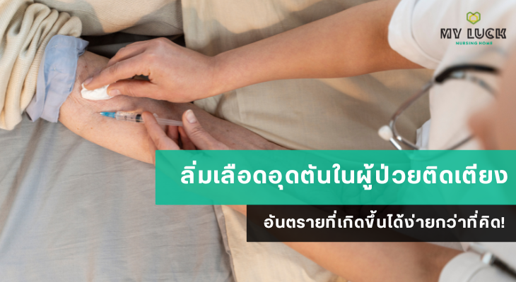 ลิ่มเลือดอุดตันในผู้ป่วยติดเตียง อันตรายที่เกิดขึ้นได้ง่ายกว่าที่คิด