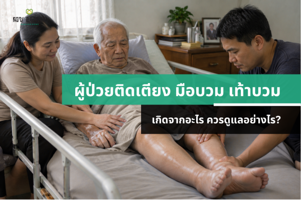 ผู้ป่วยติดเตียง มือบวม เท้าบวม เกิดจากอะไร ควรดูแลอย่างไร