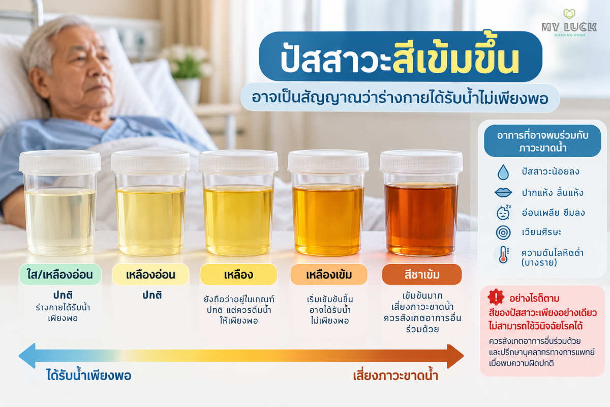 สีเข้มขึ้นเรื่อยๆ ร่างกายอาจกำลังบอกว่า “น้ำไม่พอ”